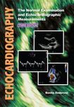 Echocardiography: The Normal Examin