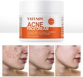 Acne Treatment for Face, Acne Cream