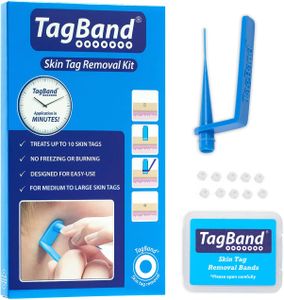 Tagband Skin Tag Remover – Large Size for Easy Home Use