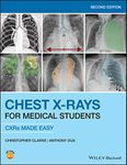 Chest X-Rays for Medical Students: CXRs Made Easy, 2nd Edition