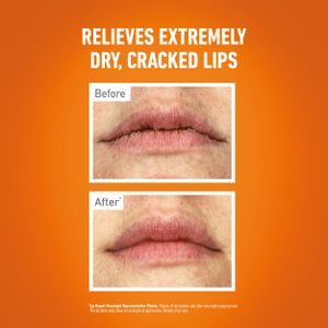 O'Keeffe's Lip Repair Overnight Balm, 7g – Intensive Moisture