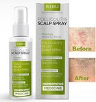 Folliculitis Scalp Spray | Dandruff Treatment for Dandruff, Psoriasis & Folliculitis | Antifungal & Anti Dandruff Itchy Scalp Treatment Formula Spray for Dry and Irritated Scalp