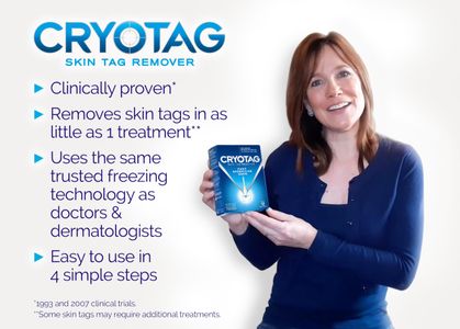 Cryotag Skin Tag Remover – Easy At-Home Skin Tag Removal