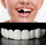 2 Pairs Fake Teeth Adjustable Dentu