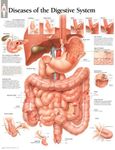 Diseases of Digestive System chart: Laminated Wall Chart