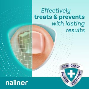 Nailner Fungal Nail Treatment Pen – Antifungal Solution for Nails