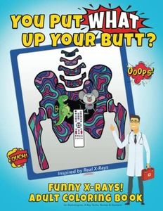 You Put What Up Your Butt? Funny Adult Coloring Book for Radiologists, X-Ray Techs, Nurses & Doctors: 1