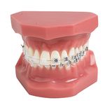 YOUYA DENTAL TM-208 Demonstration Orthodontic Model Teeth Teach Study Tools with Metal and Ceramic Bracket(Red)