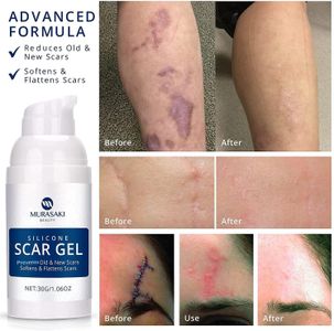 Silicone Scar Gel 30g – Scar Removal Cream for C-Section, Acne, Stretch Marks