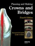 Planning and Making Crowns and Bridges