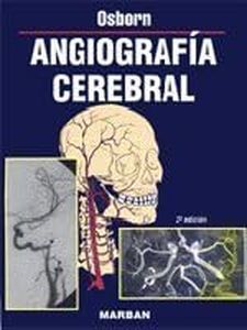 Angiografía cerebral