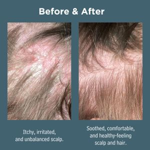 Sea Magik Salicylic Acid Shampoo 300ml – Scalp Care Cleanser