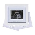 IHEIPYE Baby Sonogram Photo Frame -