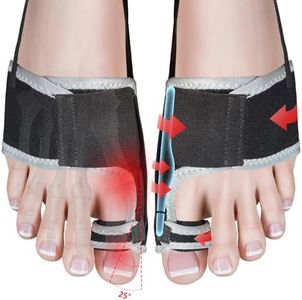 GIMCALO Adjustable Bunion Corrector For Women, Big Toe Separator Pain Relief, Hammer Toe Straightener, Non-Surgical Hallux Valgus Correction, Orthopedic Bunion Splint Day Night Support for Men(2PCS)