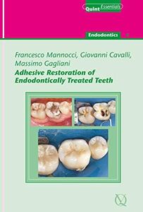 Adhesive Restoration of Endodontically Treated Teeth: Endodontics 4 (QuintEssentials of Dental Practice Book 40)