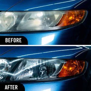Turtle Wax Headlight Restoration Kit – Complete Lens Cleaning System