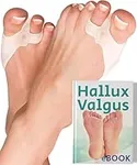 YOGAMEDIC® Bunion Corrector Toe Separator with Adjustable Gel-Pad to Spread & Stretch 6Pcs for Hallux Valgus & Bunion Support- 0% BPA Soft Silicone One-Size Pads Protector for Overlapping Toes Unisex