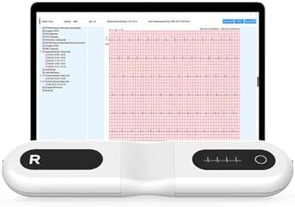 Checkme 72 Stunden EKG Gerät mit AI-EKG Analysebericht für Zuhause, Brustgurt EKG Monitor Unterstützung für PC Software, mit 10 Standard-Elektrodenpads
