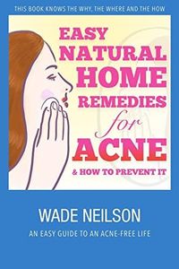 Acne: Easy Natural Home Remedies for Acne & How to Prevent It