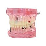 Dentalmall Teeth Model Teeth Typodo