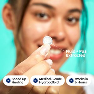 Patch Perfect Hydrocolloid Pimple Patches, 102 Count – Acne Spot Treatment