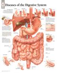 Diseases of Digestive System chart: Laminated Wall Chart