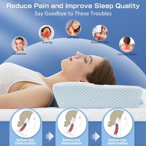Memory Foam Cervical Pillow – Orthopedic Neck Support