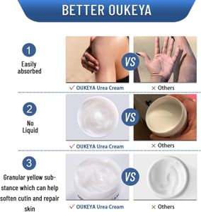 OUKEYA Urea Cream 40% – Intensive Moisturizing Foot & Hand Care