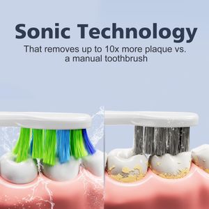7AM2M Sonic Electric Toothbrush, Pink – Rechargeable, Soft Bristles
