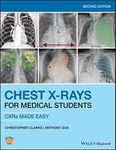 Chest X-Rays for Medical Students: 