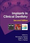 Implants in Clinical Dentistry