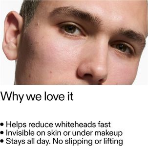 INKEY List Hydrocolloid Pimple Patches – Acne Spot Treatment