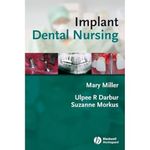 Implant Dental Nursing