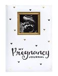 Pearhead My Pregnancy Journal, Baby Keepsake, Pregnancy Memory Book, White And Gold With Black Hearts,1 Count