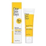 Clear Skin Days Blemish Treatment Cream - Overnight Spot & Acne Treatment for Face - with Salicylic Acid & Zinc - Calm Aggravated Skin, Treat Blemishes & Acne 30ml