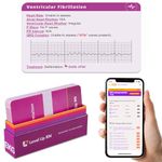 Level Up RN – EKG Interpretation Flash Cards – for Nursing/EMT/Paramedic School – 2024 NCLEX ATI HESI Review LPN RN Flash Cards (45 Cards)