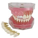 Dental Implant Teeth Model Study Te