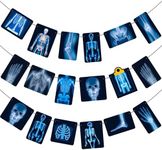 Radiology X Ray Theme Banners Radiology Birthday Party Decorations X Ray Party Banner Garlands for Radiology Doctor Birthday Party X Ray Medical Theme Party Baby Shower Supplies