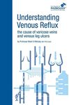 Understanding Venous Reflux the Cause of Varicose Veins and Venous Leg Ulcers: Varicose veins and venous leg ulcers