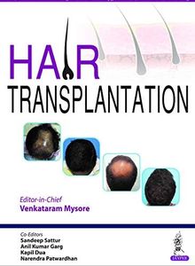 Hair Transplantation