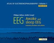 Atlas of Electroencephalography. Aw