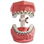 Orthodontic Dental Model with Brack