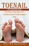 Toenail Fungus Treatments