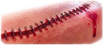 Pack of 2 Stitches Unpainted Silico