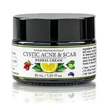 Cystic Acne & Scar Herbal Cream Bla