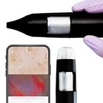 Digital Otoscope and Dermascope in Single Device (Oto-Dermascope) for Clinical Examination and Saving Pictures and Videos