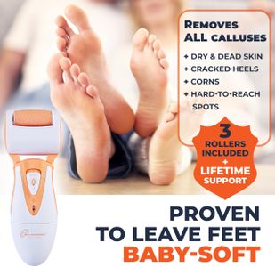 Own Harmony Electric Callus Remover – Rechargeable Foot File