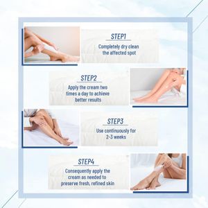 OUKEYA Urea Cream 40% – Intensive Moisturizing Foot & Hand Care