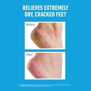 O’Keeffe’s Healthy Feet Cream 80ml – Intensive Moisturizer
