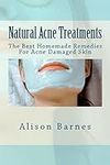 Natural Acne Treatments: The Best H